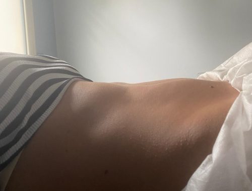 dopo
