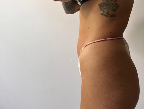 dopo4